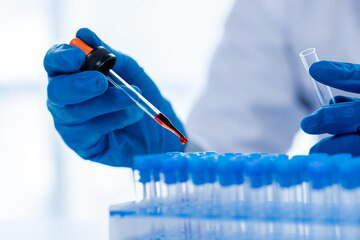 [Share]Precision parts processing. Unleash the potential of in vitro diagnostic devices